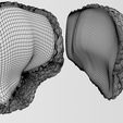 w9.jpg 3D Alchoholic liver disease cirrhosis hepatitis fatty model