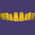 Screenshot-2026-08-23-173514.png DA2600 Library for Exocad