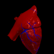 4.png 3D Model of the Heart with Tetralogy of Fallot, parasternal long axis