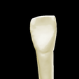13.png Left Lower Lateral Lateral Incisor #32