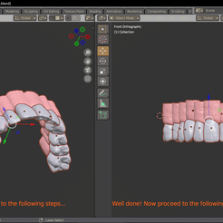 imagen_2022-09-18_223835824.png OBJ file 3. UPPER ARCH TEETH WITH SOCKET AND TEXTURED GINGIVA・3D printer model to download