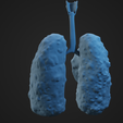 HLC_Render3.png Human Lung Cancer