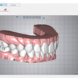 11 Hole - Impression 1 ( Treatment Planning Exporting Web Viewer «JOS fF Hole Fix Label Delete Label Upper Jaw Lower Jaw Export Al Setups Export Documnets ax fa ax\e © seupit ° MD ve RoT TQ wo| 3 41(R)CenIncisor 0.00 -0.20 0.00 -8.00 0.00 -4.00 g 42(R)LatIncisor -0.40 -0.30 0.00 12.00 -6.00 0.00 43 (R) Canine -040 -0.40 0.00 20.00 0.00 0.00 44(R)F.Premolar -1.30 -0.70 0.00 30.00 0.00 0.00 45(R)S.Premolar -0.70 -0.40 0.00 30.00 0.00 0.00 46 (R) F. Molar 0.00 0.00 0.00 0.00 0.00 0.00 31(L)CenIncisor 0.00 0,00 0.00 12.00 0.00 4,00 32(L) Lat incisor -0.40 0.20 0,00 -2.00 0.00 4,00 33 (L) Canine 0.00 0.20 0.00 -10.00 0.00 0.00 34(L)F.Premolar 0.00 0,00 0.00 -32.00 0.00 0.00 35(L)S.Premolar 0.00 -0.10 0,00 -12.00 0.00 0.00 36 (L) F. Molar 0.00 -040 0.00 0.00 0.00 0.00 Version 5.0.4 TRANSPARENT ALIGNERS Pac A. 21 dental models or setups of UPPER AND LOWER MAXILLARY "READY FOR 3D PRINTER" - AREA3D - PATIENT A. COMPLETE DENTURE