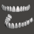 Model-B.png Aesthetic Tooth Libraries