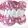 Screenshot_15.png Digital Full Dentures for Gluedin Teeth with Manual Reduction