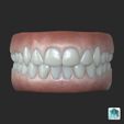 05_MAYA.jpg Human teeth with gums