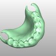 Clipboard-2024-02-25-15-10-20.jpg FLEXIBLE PARTIAL DENTURE (upper base + artificial teeth)