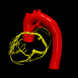18.png 3D Model of Heart with Tetralogy of Fallot (ToF)