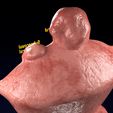 0019.jpg Fibroid Uterus Human female 3D