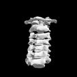 vertebra-2.jpg Archivo STL El modelo de la columna cervical C1-C7 con una parte del cráneo・Modelo para descargar y imprimir en 3D