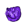 Neonatal Pulmonary Atresia VSD.stl HEART