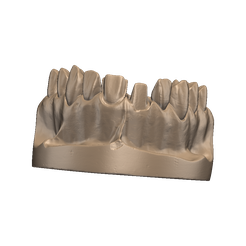 2019-08-20_00001-001-UpperJaw.png STL file teeth・3D printing design to download