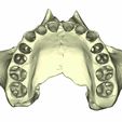 21.jpg maxilar con dientes