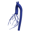 2.png 主动脉和冠状动脉 3D 模型 - 6 件装