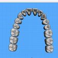 Dentes-Maxila-Alternative-Exocad-02.jpg Teeth Upper Jaw - Exocad - Alternative