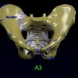 pelvis-fracture-classifications-3d-model-blend-24.jpg Pelvis fracture classifications 3D model