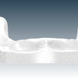 Screenshot_5.png Digital Full Dentures for Gluedin Teeth with Manual Reduction
