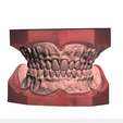Screenshot_12.png Digital Try-in Full Dentures for Injection Molding