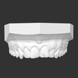 Capture d’écran 21.png teeth, dent, dental, dental, denti, bocca, Zahn,