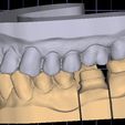 WhatsApp-Image-2024-04-14-at-11.54.51.jpeg Digital dental model for practice