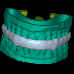 FullModel.png Dental Model BiteSplint
