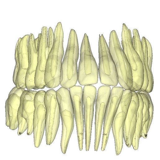 STL file teeth with canals・Model to download and 3D print・Cults