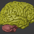 1.png 3D Model of Brain