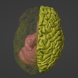 4.png 3D Model of Brain