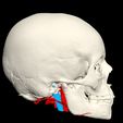 i15.jpg 3D Model of Brain Arteriovenous Malformation