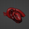 w4.png 3D Model of Heart with Atrial Septal Defect