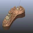 Capture2.jpg STL file Dental Model Master with Dies 11 15 16・3D printer design to download