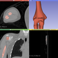 2022-05-02-Scene.png radius ulna and humerus