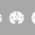 wf8.jpg Alzheimer Disease Brain coronal slice