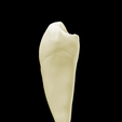 12.png First lower left first premolar #34