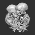 12.jpg Fetus infant skeleton
