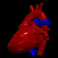 5.png 3D Model of Heart after Fontan Procedure