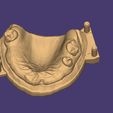 Clipboard-2024-12-21-00-37-21.jpg DIGITAL FLEXIBLE UPPER PARTIAL DENTURE  (3D models !!!) - 7 stl files for download)