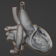 23.png 3D Model of Heart after Fontan Procedure
