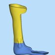 1.jpg leg orthosis brace lower