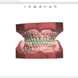 Screenshot_6.png Digital Try-in Full Dentures for Injection Molding