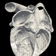 9.png 3D Model of Heart (apical 5 chamber plane)