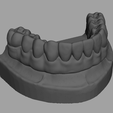 Captura-de-tela-2023-10-24-112659.png dental prosthesis