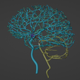 21.png 3D Model of Brain and Aneurysm