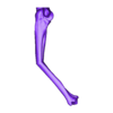 Both%20bone%20malunion%20sag%2040%20degrees.stl Entire collection of simulated forarm angulated malunions