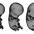 6_Weeks_Wireframe.png 6 Weeks Human embryonic (baby stages)