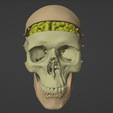 1.png 3D Model of Skull and Brain with Brain Stem