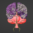 11.png 3D Model of Brain and Aneurysm