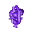 5.papvc.stl Congenital Heart Disease - 7pack