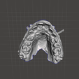 upr.png Orthodontics dental model 2