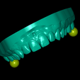 UpperJaw-articulator.png Modèle dentaire avec 10 facettes et articulateur